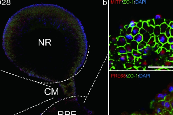 陈建苏、唐仕波团队最新研究成果：​视网膜类器官长期培养及应用